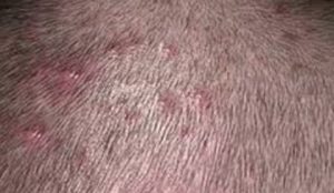 small Red Painful Bumps on Scalp