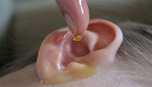How to Treat an Itchy Ear Canal - Ear Drops