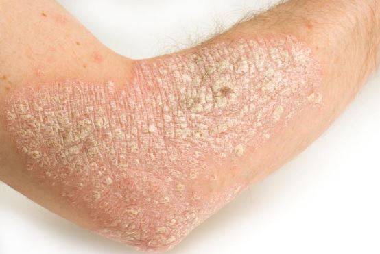 rash-on-arms-and-legs-itchy-red-causes-small-bumps-pictures-not