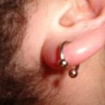 swollen-ear-lobe-piercing