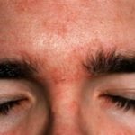 itchy-eyebrows-causes