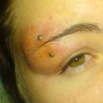 swollen-eyebrow-piercing