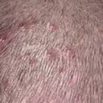 Bumps on Scalp that Hurt