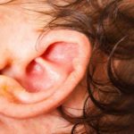 Ear Canal Eczema Symptoms include Itching