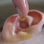 How to Treat an Itchy Ear Canal – Ear Drops