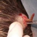 Infected Ingrown Hair on Scalp Picture