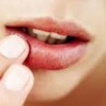 Itchy Lips Symptoms