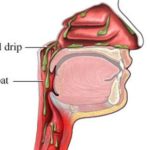 Post Nasal Drip causing constant cough and tickly throat