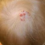 Red Bumps on Scalp Images