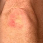 Red Itchy Elbow Skin Causes