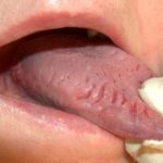 Scalloped Tongue Meaning – Pictures