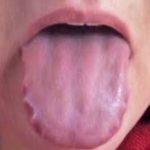 Scalloped Tongue Pictures