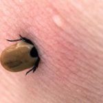 Tick Paralysis in Humans