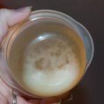 White Stuff in Urine